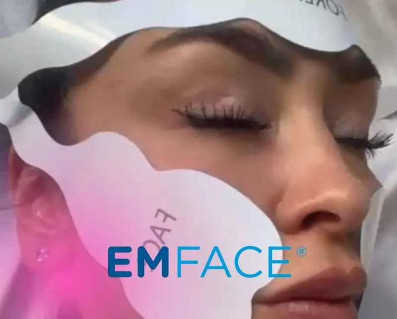 EMFACE - 